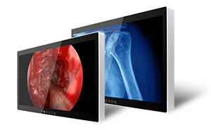 4K-UHD Medical Display